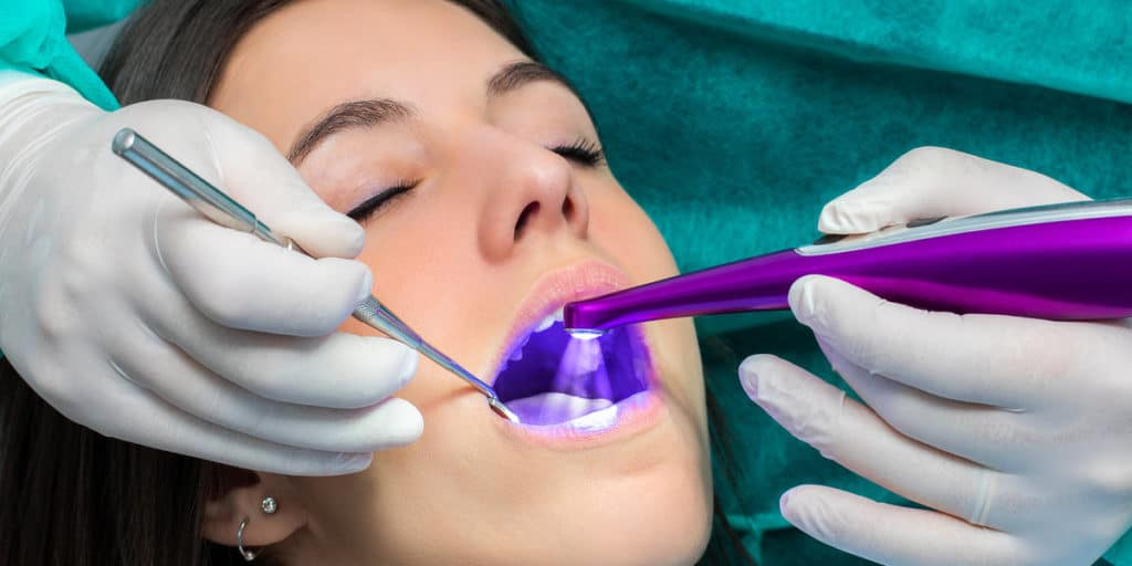 dental sealants - Wortley Road Dental