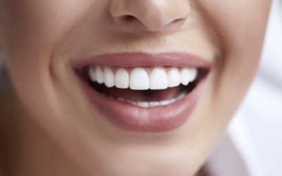 How Much Do Veneers Cost?