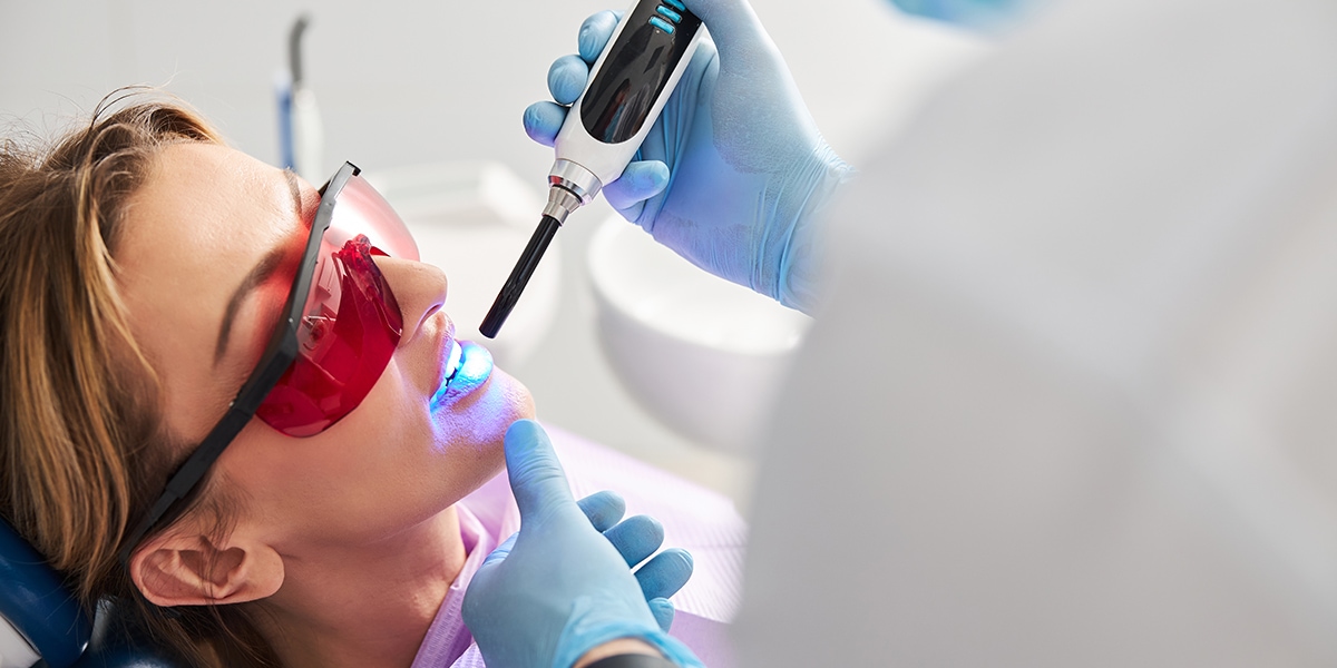 Stomatologist setting dental sealants in person teeth