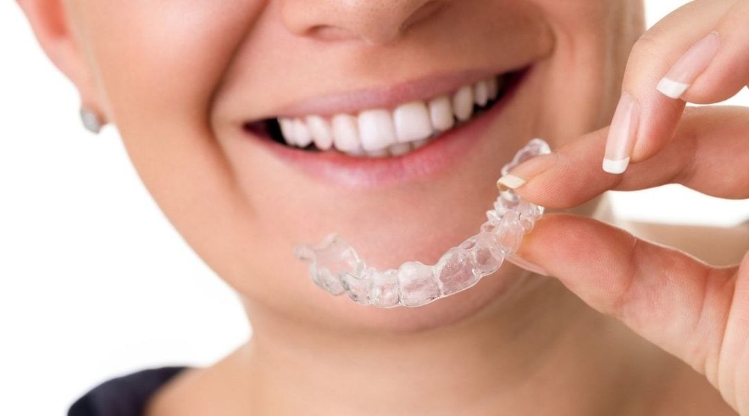 Why Invisalign In London Ontario Works Best For Your Smile