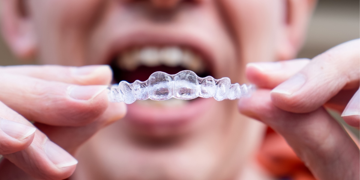 Invisalign Braces Reliable Solution For London Orthodontics Wortley
