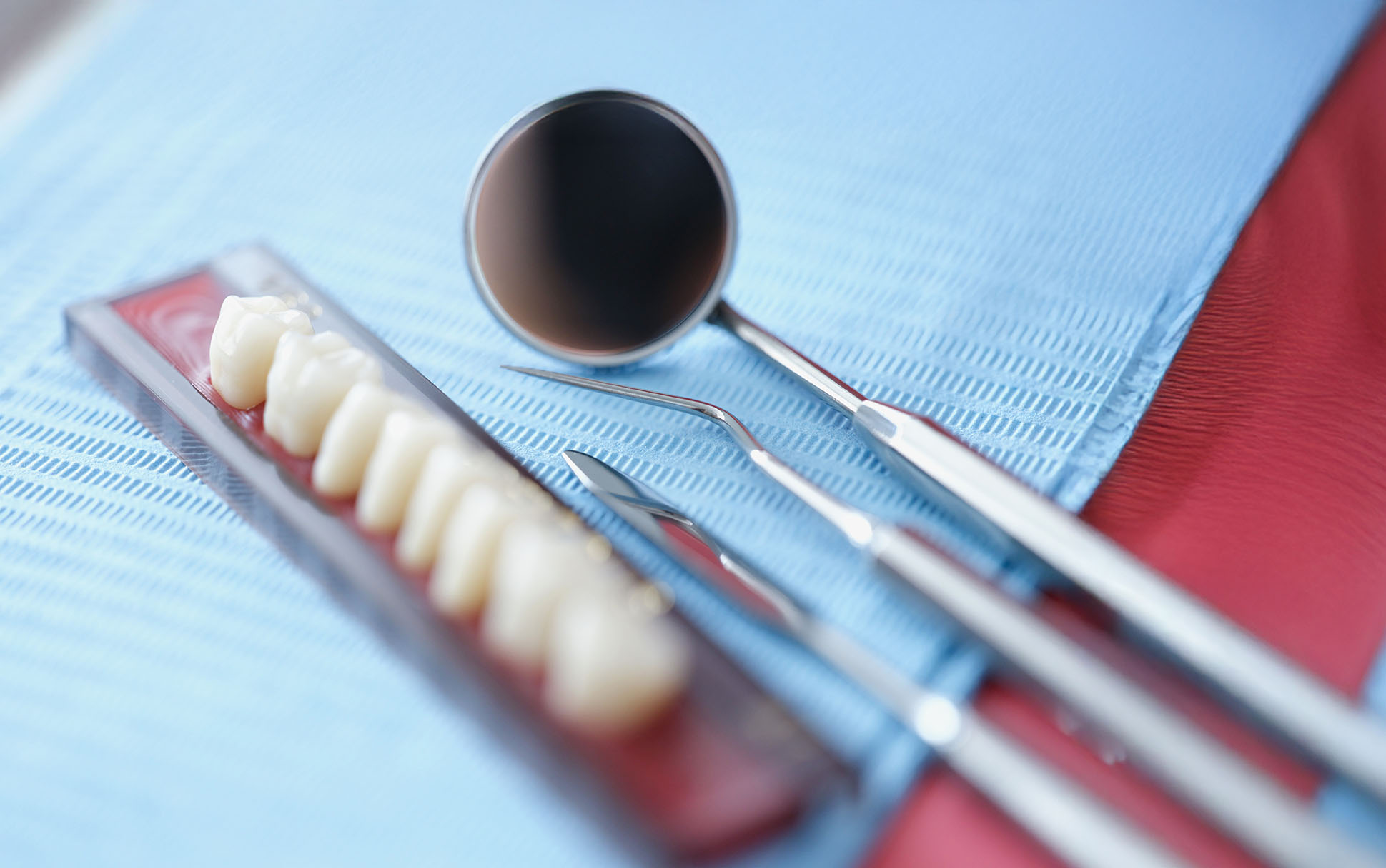 Full Mouth Reconstruction